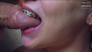 Attractive Teeny with Braces do Bj and Recieve Jizz in Mouth